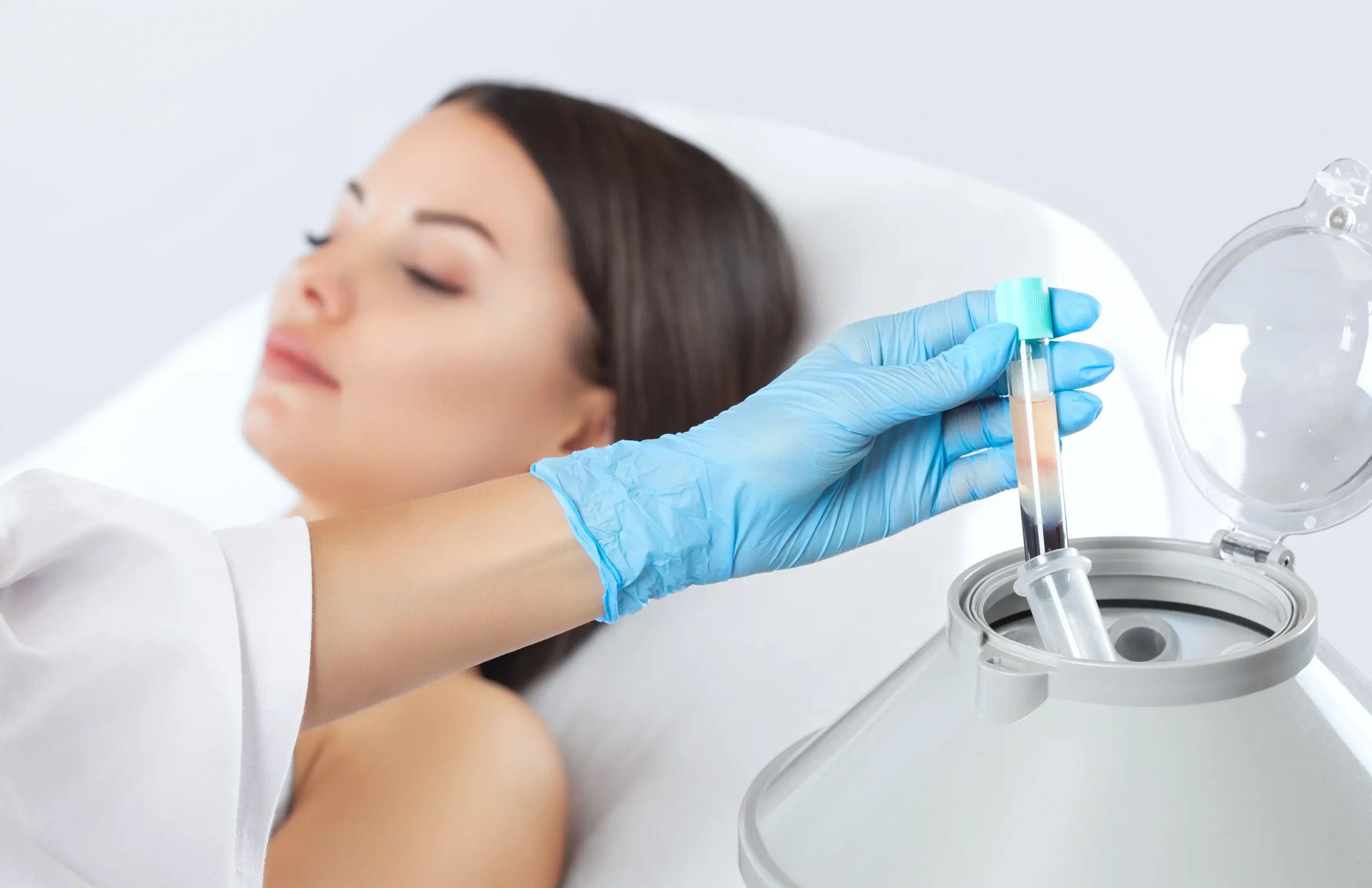 Vampire Facelift